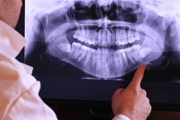 Best Emergency Treatment for Dental Infections or Abscesses in Derwood, MD