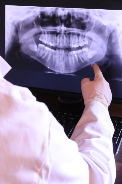 Best After-Hours Dental Trauma Care in Derwood, MD